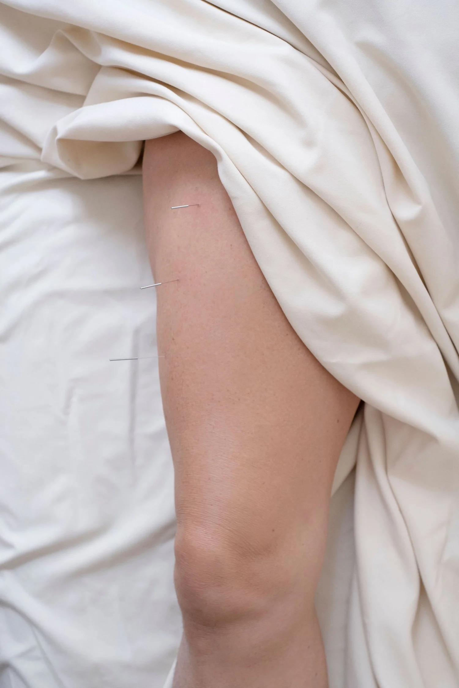 Acupuncture treatment session for pain relief and wellness at Point Acupuncture in Portland, Maine