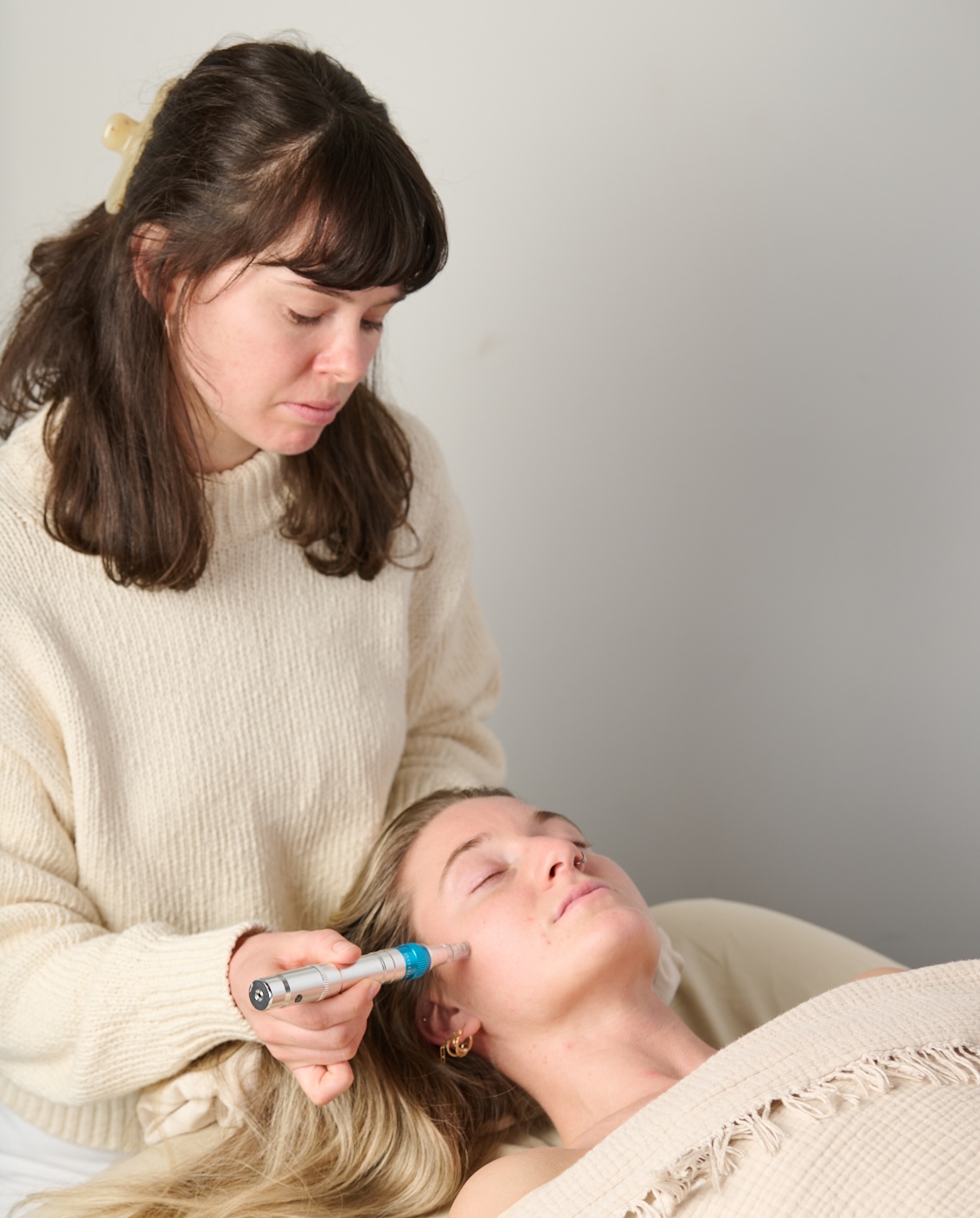 Microneedling treatment for skin rejuvenation at Point Acupuncture in Portland, Maine