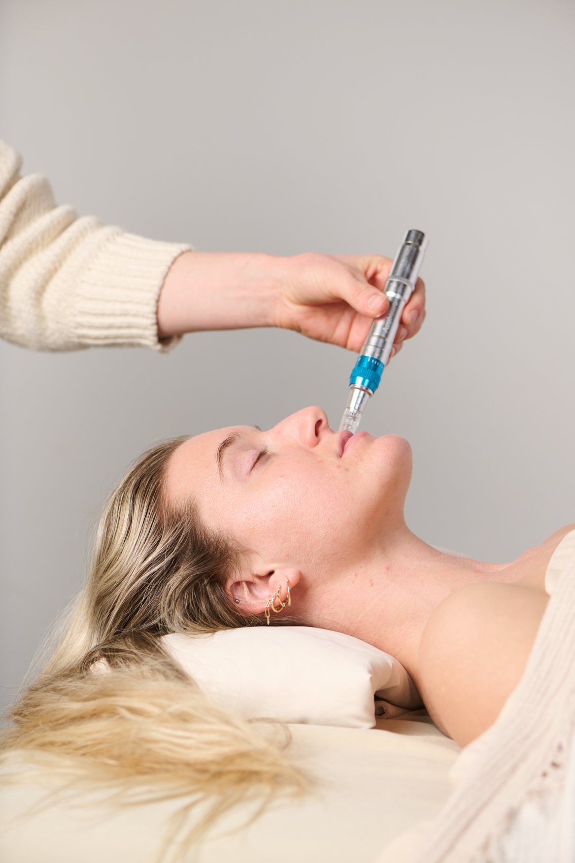 AcuMicro precision microneedling treatment at Point Acupuncture in Portland, Maine