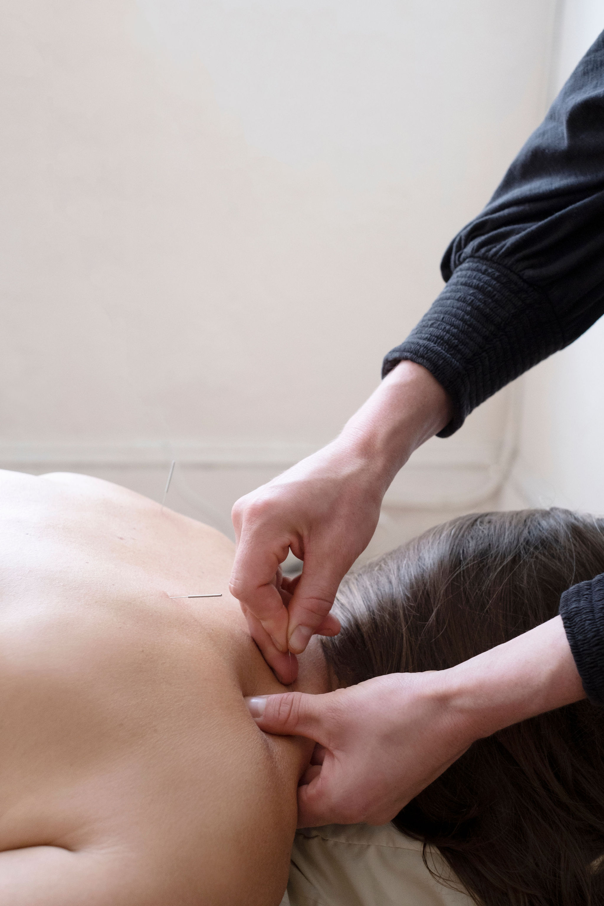 Dr. Hannah Dietz performing dry needling treatment for musculoskeletal injury at Point Acupuncture in Portland, Maine